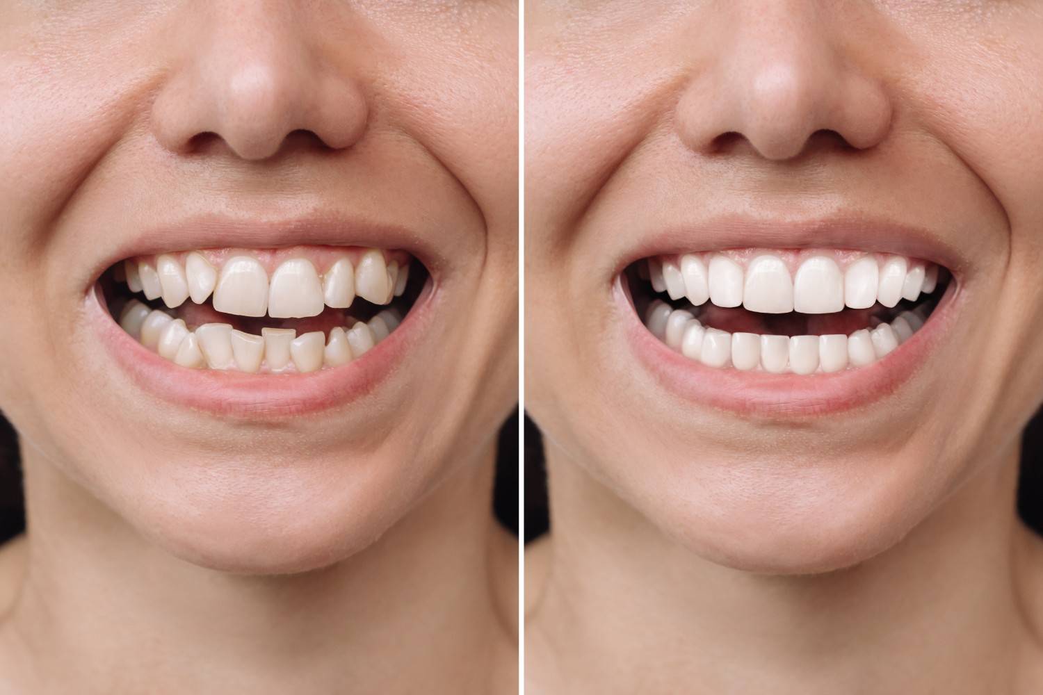 Cosmetic Dentistry